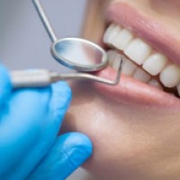 Преимущества отбеливание зубов