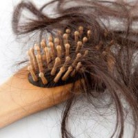 Причины выпадения волос у женщин — как лечить волосы