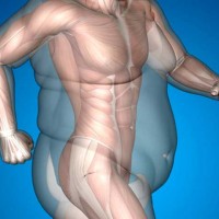 Причины лишнего веса – которые не связаны с питанием
