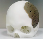 3D-печать костной ткани